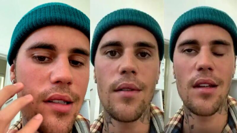 Explained: Ramsay Hunt Syndrome that paralyzed right side of Justin Bieber’s face