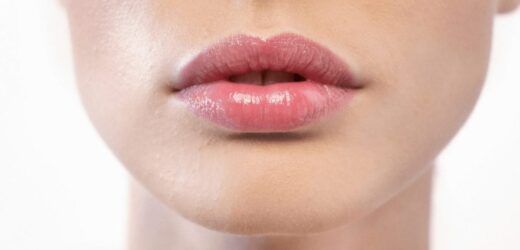 Do Lips Go Back To Normal After Fillers?