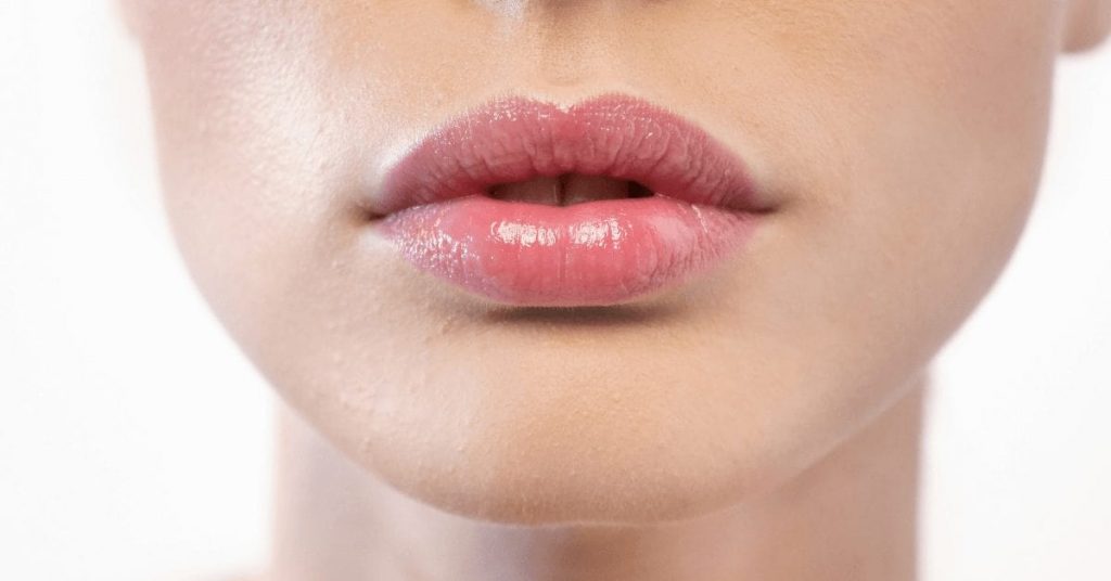 Do Lips Go Back To Normal After Fillers?